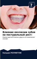 Влияние окклюзии зубов на постуральный ро