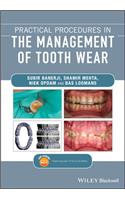 Practical Procedures in the Management of Tooth Wear