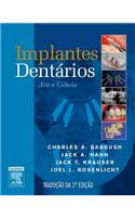 Implantes Dentarios