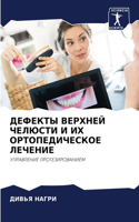 ДЕФЕКТЫ ВЕРХНЕЙ ЧЕЛЮСТИ И ИХ ОРТОПЕДИЧЕСК