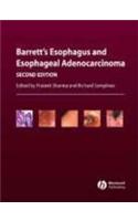Barrett's Esophagus and Esophageal Adenocarcinoma