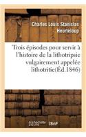 Trois Épisodes Pour Servir À l'Histoire de la Lithotripsie Vulgairement Appelée Lithotritie
