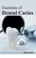 Essentials of Dental Caries