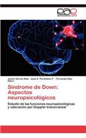 Síndrome de Down