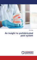 An insight to prefabricated post system