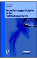 Verankerungsprinzipien in Der Ha1/4ftendoprothetik
