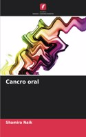 Cancro oral