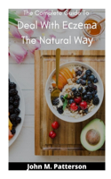 The Complete Guide To Deal With Eczema The Natural Way