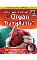 What Are the Limits of Organ Transplantation?