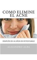 Como Elimine el ACNE