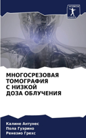 МНОГОСРЕЗОВАЯ ТОМОГРАФИЯ С НИЗКОЙ ДОЗА О&#1041