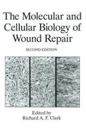 Molecular and Cellular Biology of Wound Repair