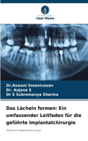 Lächeln formen: Ein umfassender Leitfaden für die geführte Implantatchirurgie