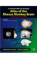A Combined MRI and Histology Atlas of the Rhesus Monkey Brain in Stereotaxic Coordinates: With Horizontal, Coronal, and Sagittal Series