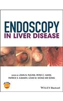 Endoscopy in Liver Disease