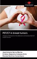 PET/CT in breast tumors
