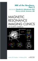 MRI of the Newborn, Part 2, an Issue of Magnetic Resonance Imaging Clinics
