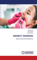 Indirect Bonding