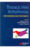 Thoracic Vein Arrhythmias