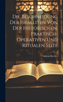 Beschneidung der Israeliten von der historischen, praktisch-operativen und ritualen Seite