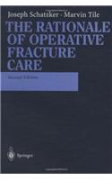 The Rationale of Operative Fracture Care
