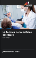 tecnica della matrice occlusale