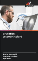 Brucellosi osteoarticolare