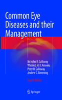 Common Eye Diseases and Their Management