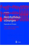 Herzrhythmusstarungen: Diagnostik Und Therapie