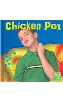Chicken Pox