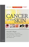 Cancer of the Skin