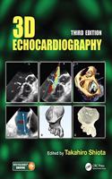 3D Echocardiography