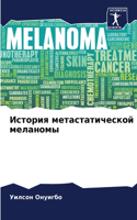 История метастатической меланомы