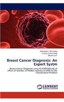 Breast Cancer Diagnosis