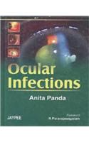 Ocular Infection