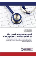 Ostryy Koronarnyy Sindrom S Elevatsiey St