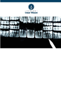 Wurzelresorption