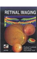 Retinal Imaging