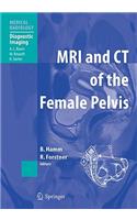 MRI and CT of the Female Pelvis