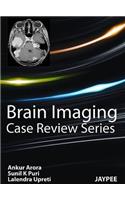 Brain Imaging