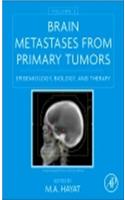 Brain Metastases from Primary Tumors, Volume 2