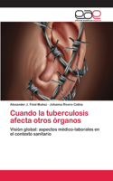 Cuando la tuberculosis afecta otros órganos