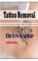 Tattoo Removal: The Low Cost Way