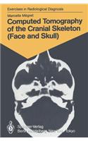Computed Tomography of the Cranial Skeleton (Face and Skull): 58 Radiological Exercises for Students and Practitioners