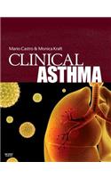 Clinical Asthma: Expert Consult - Online and Print