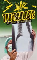 Tuberculosis