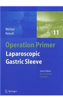 Laparoscopic Gastric Sleeve