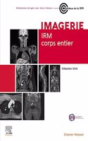 IRM corps entier