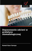 Dopasowanie odcieni w protetyce stomatologicznej