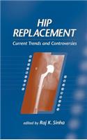 Hip Replacement